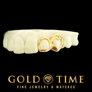 Gold open face double caps, one with a heart cut out, on a dental mold, Gold Time