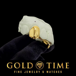 Side view of a yellow gold solid canine cap with the connecting bar running behind the front teeth