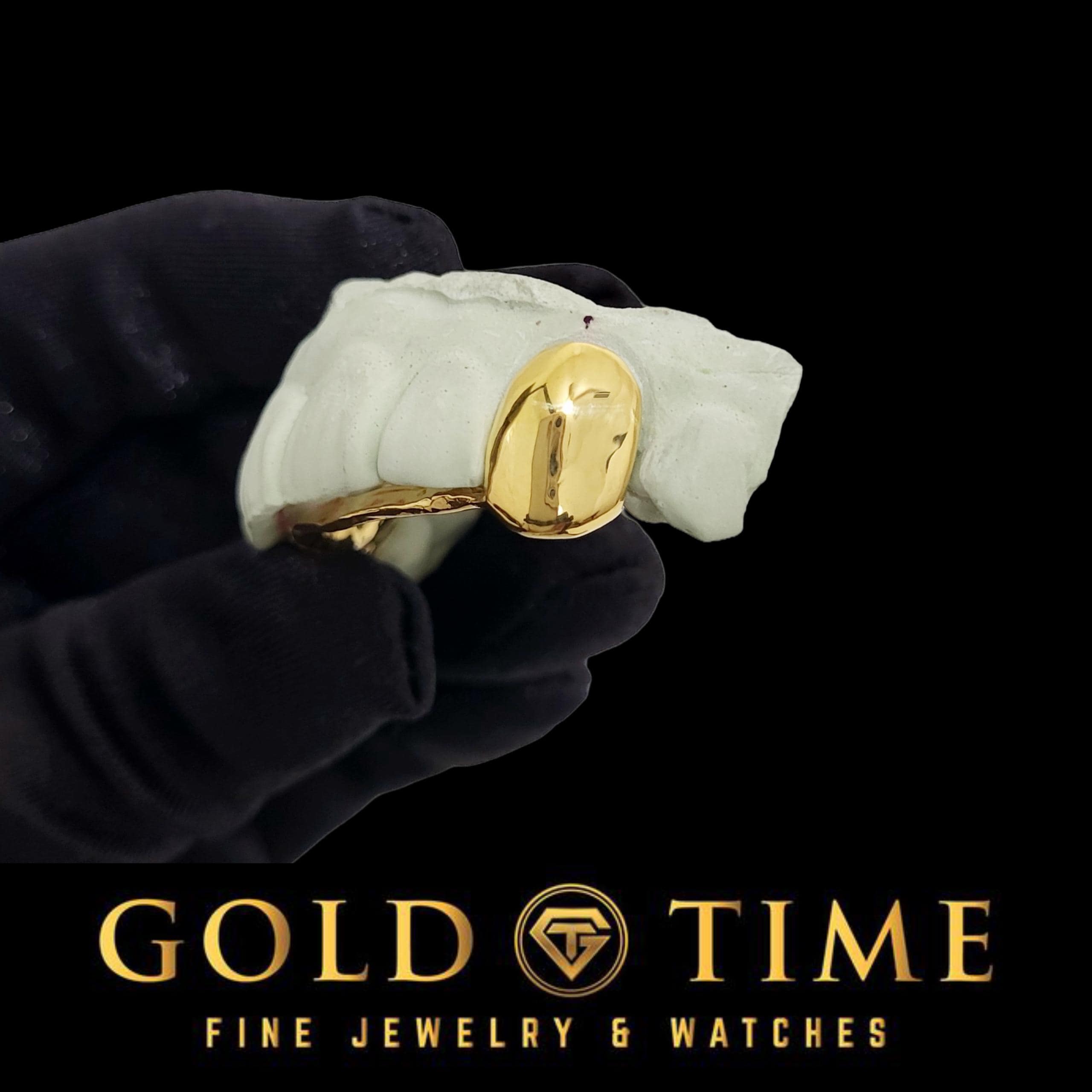 Custom 2-Piece Solid Canines   Silver or Gold