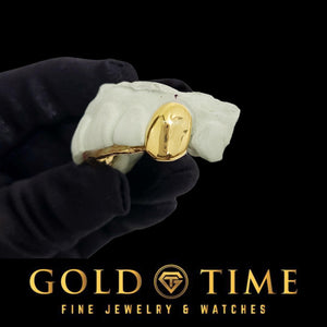 Close up of a polished yellow gold solid canine cap on a dental mold held in a gloved hand