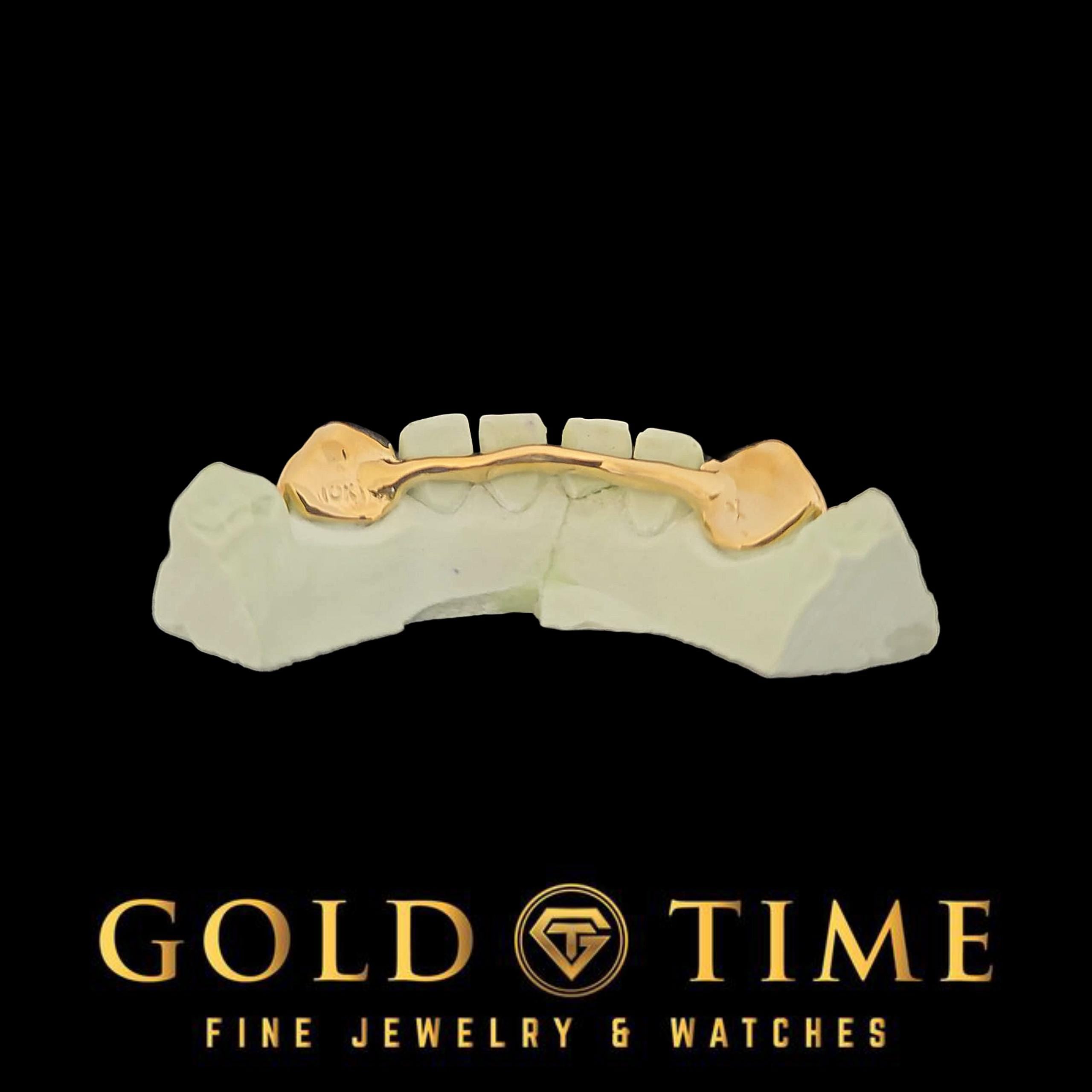 Custom 2-Piece Solid Canines   Silver or Gold