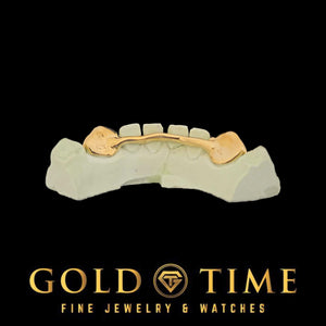 Back view of yellow gold 2 piece solid canines showing the bar that connects both caps behind the teeth