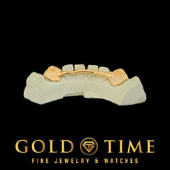 Custom 2-Piece Solid Canines   Silver or Gold