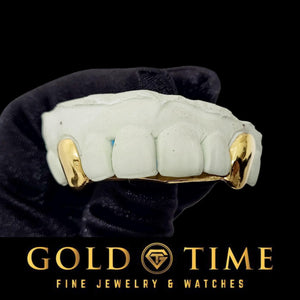 Yellow gold 2 piece solid canines with the connecting bar visible along the back of the front teeth