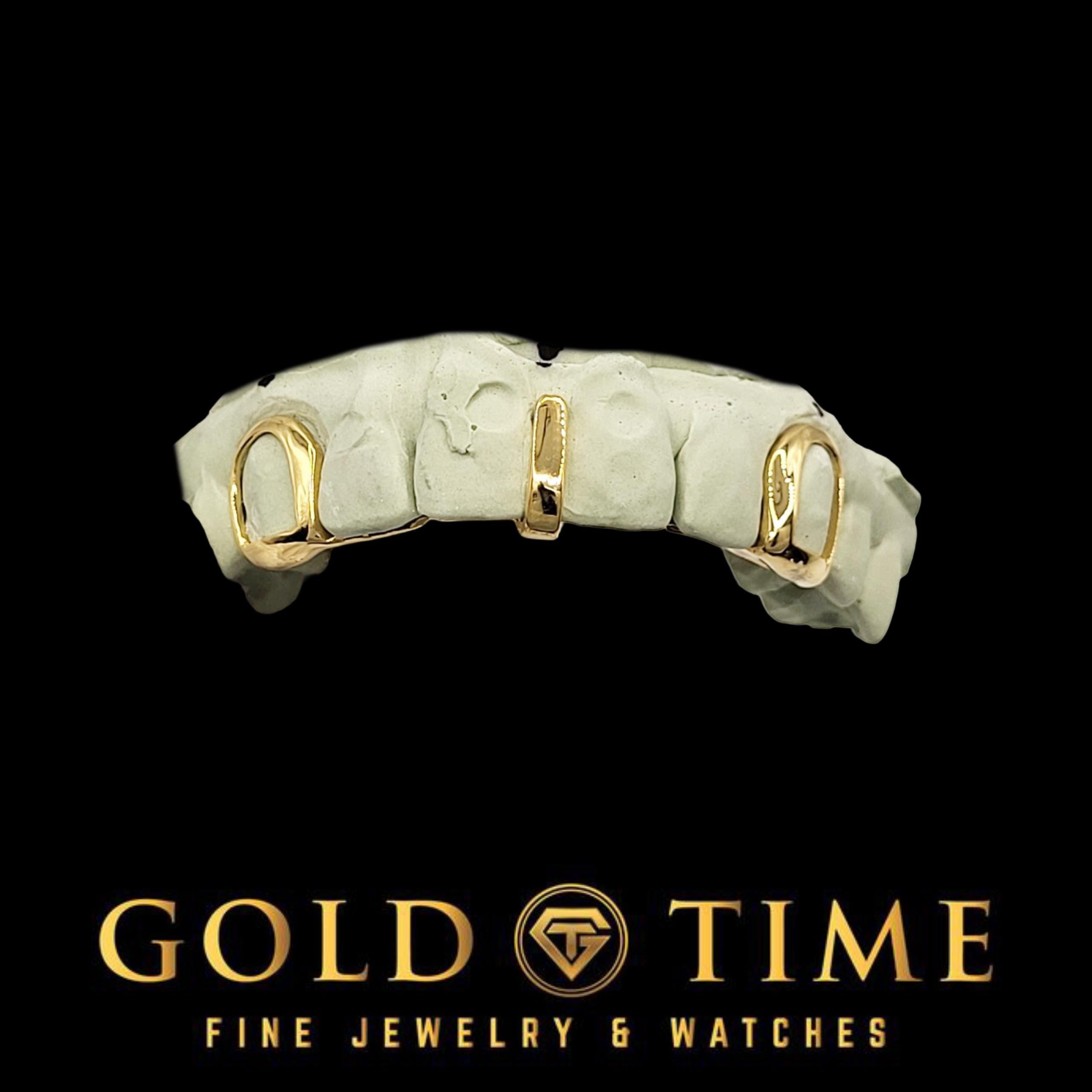 Custom 3-Piece Gold Grillz with Open Face Canines & Gap Bar