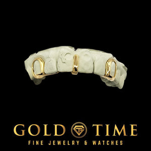Yellow gold 3 piece set with open face canines and a center gap bar on a mold