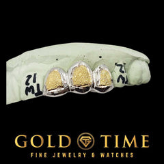 Custom Handmade Two Tone Box Dust Triple Cap Grillz