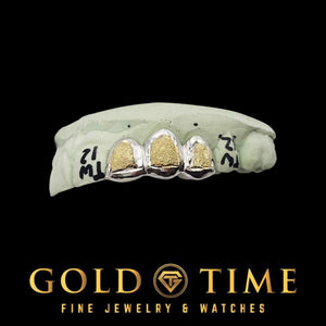 Two-tone box dust triple cap grillz in silver and 10K gold