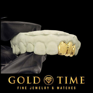 Gold dental grill with gold time branding on a black background