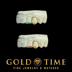 Two dental models showing the bezel stone canine and stone tip incisor in different stone colors
