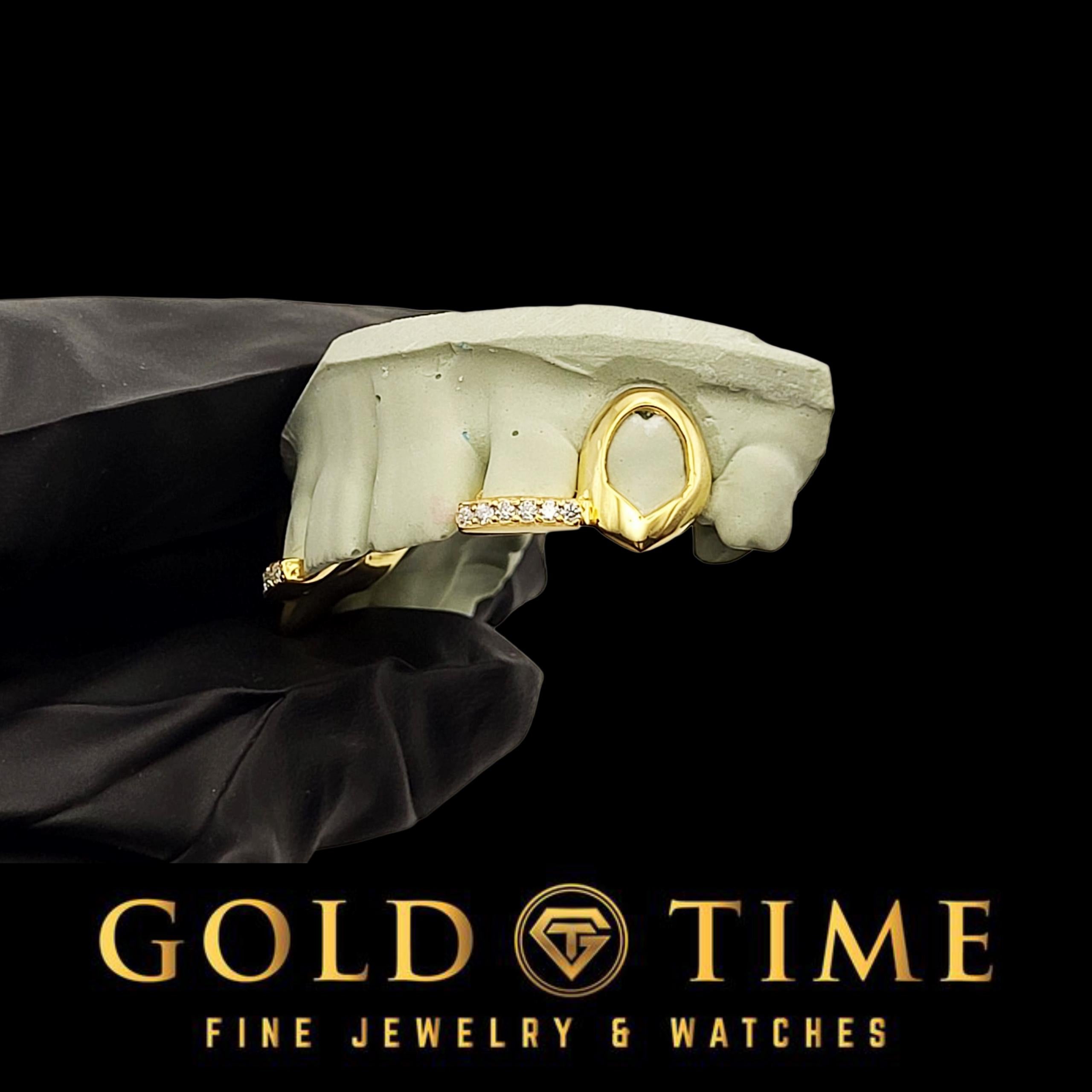 Custom 4-Piece Open Face Fangs with Moissanite Incisor Tips