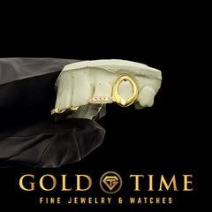 Custom 4-Piece Open Face Fangs with Moissanite Incisor Tips