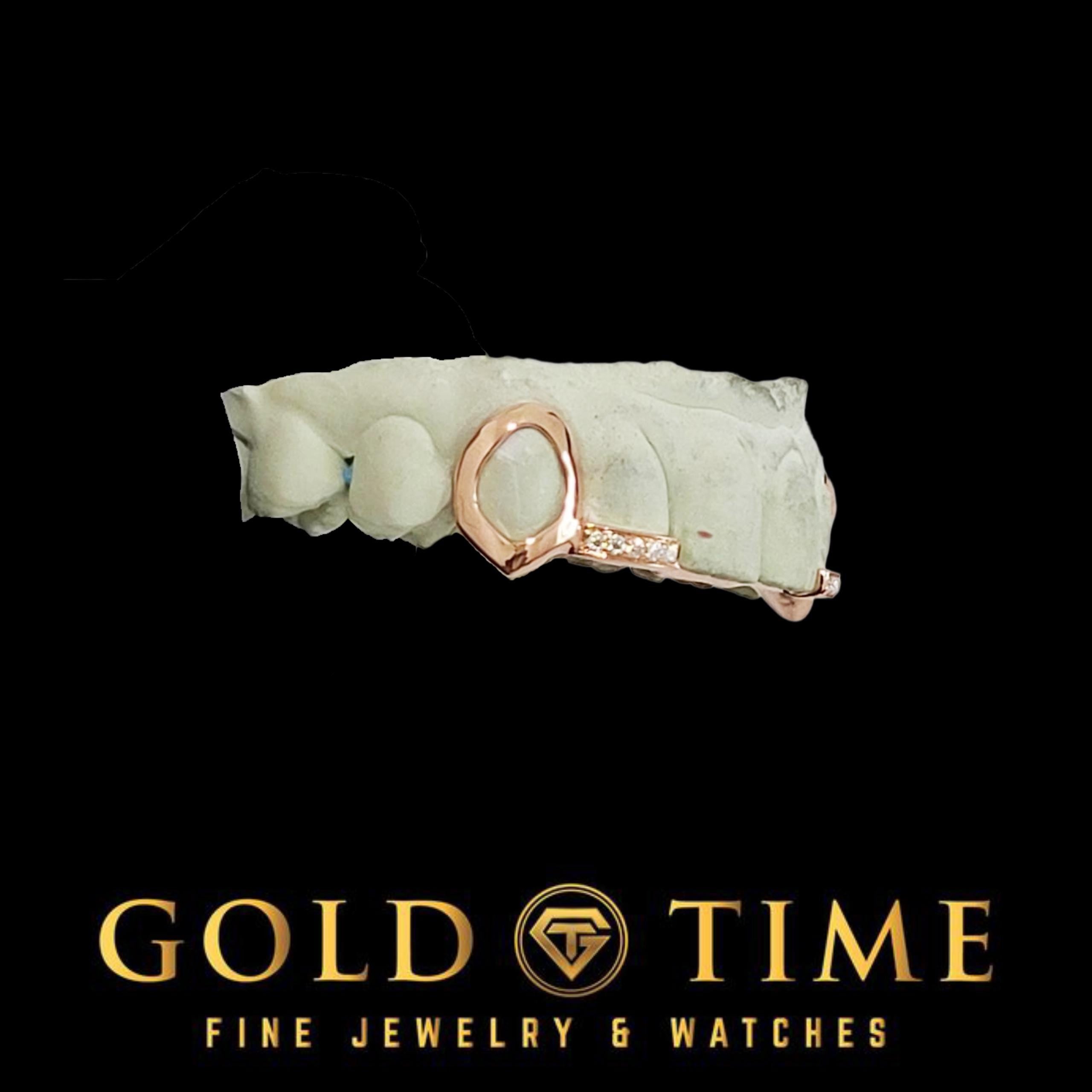 Custom 4-Piece Open Face Fangs with Moissanite Incisor Tips