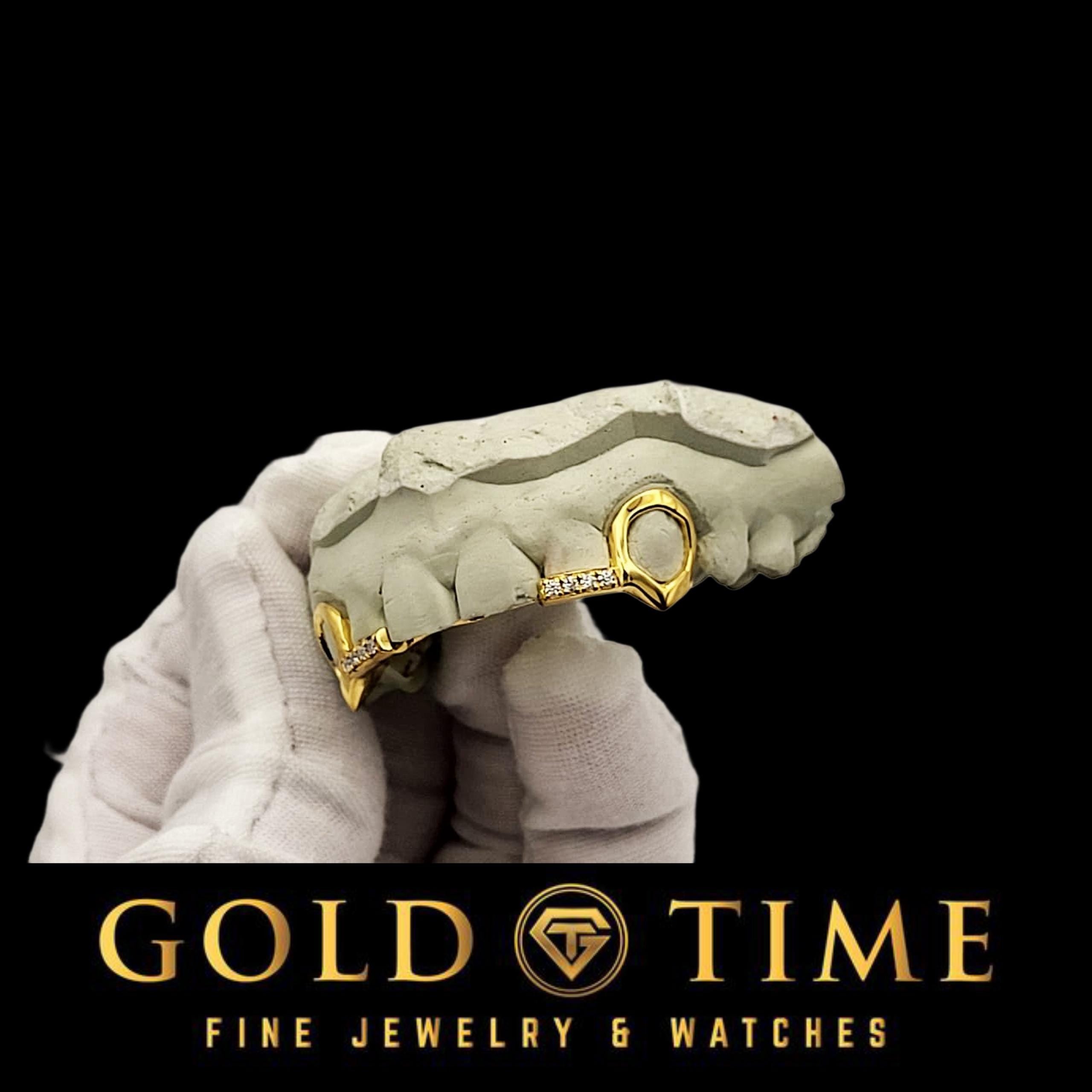 Custom 4-Piece Open Face Fangs with Moissanite Incisor Tips