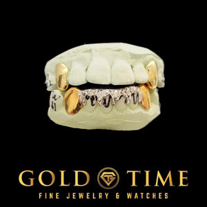 Two-tone 8 piece grillz set with solid yellow top canines and white drip bottom row