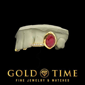 Custom 2 piece gold grill with a bezel-set red oval gem on the canine and a moissanite-lined tip on the incisor