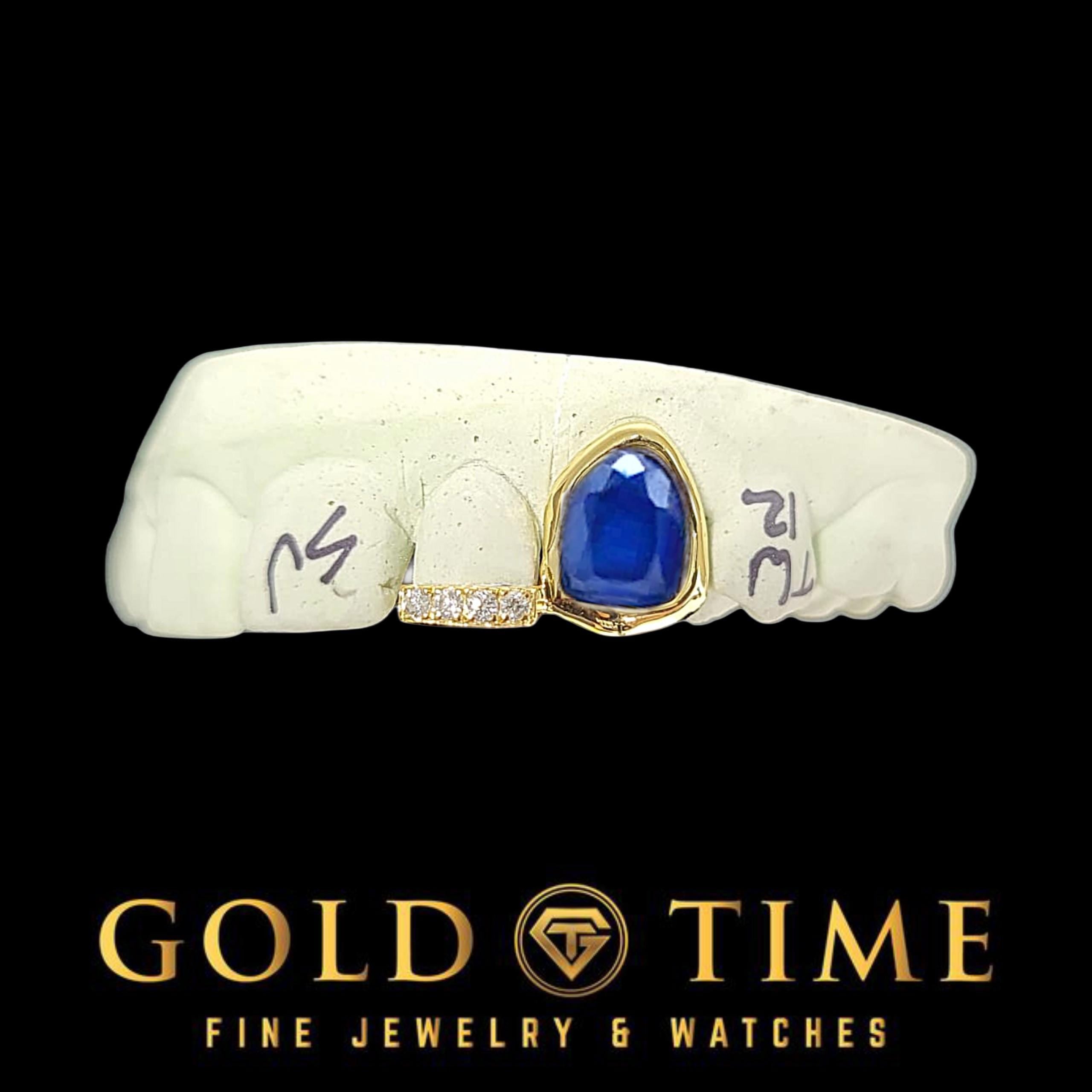 Custom 2-Piece Grillz with Oval Gem Canine & Moissanite Tip