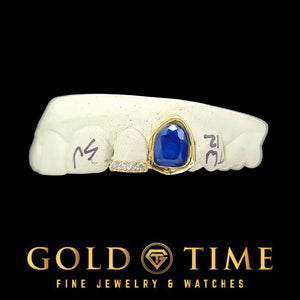 Gold double cap grill with a bezel-set blue oval gem and a moissanite incisor tip on a dental mold