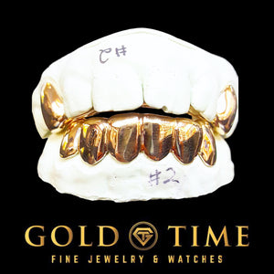 Rose gold solid top canine caps and bottom six grillz set on dental molds