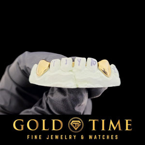 Yellow gold solid canine caps on both sides of a labeled dental mold, shown upside down in a gloved hand, Gold Time