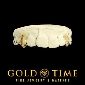 Front view of yellow gold solid canine caps on a top dental mold