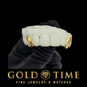 Yellow gold 2 piece solid canine grillz on a top dental mold held in a gloved hand