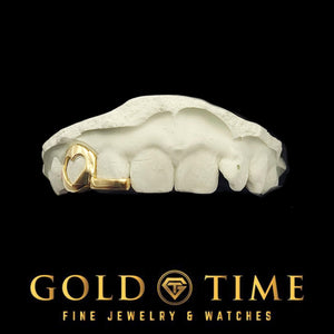 Side angle of the heart cut-out double cap grill on a white dental mold