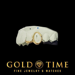 Angled view of the yellow gold open face canine cap and solid tip on a dental mold