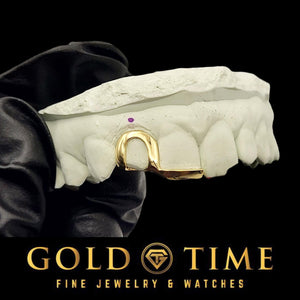 Gloved hand holding a mold with a gold open face canine and solid tip double cap