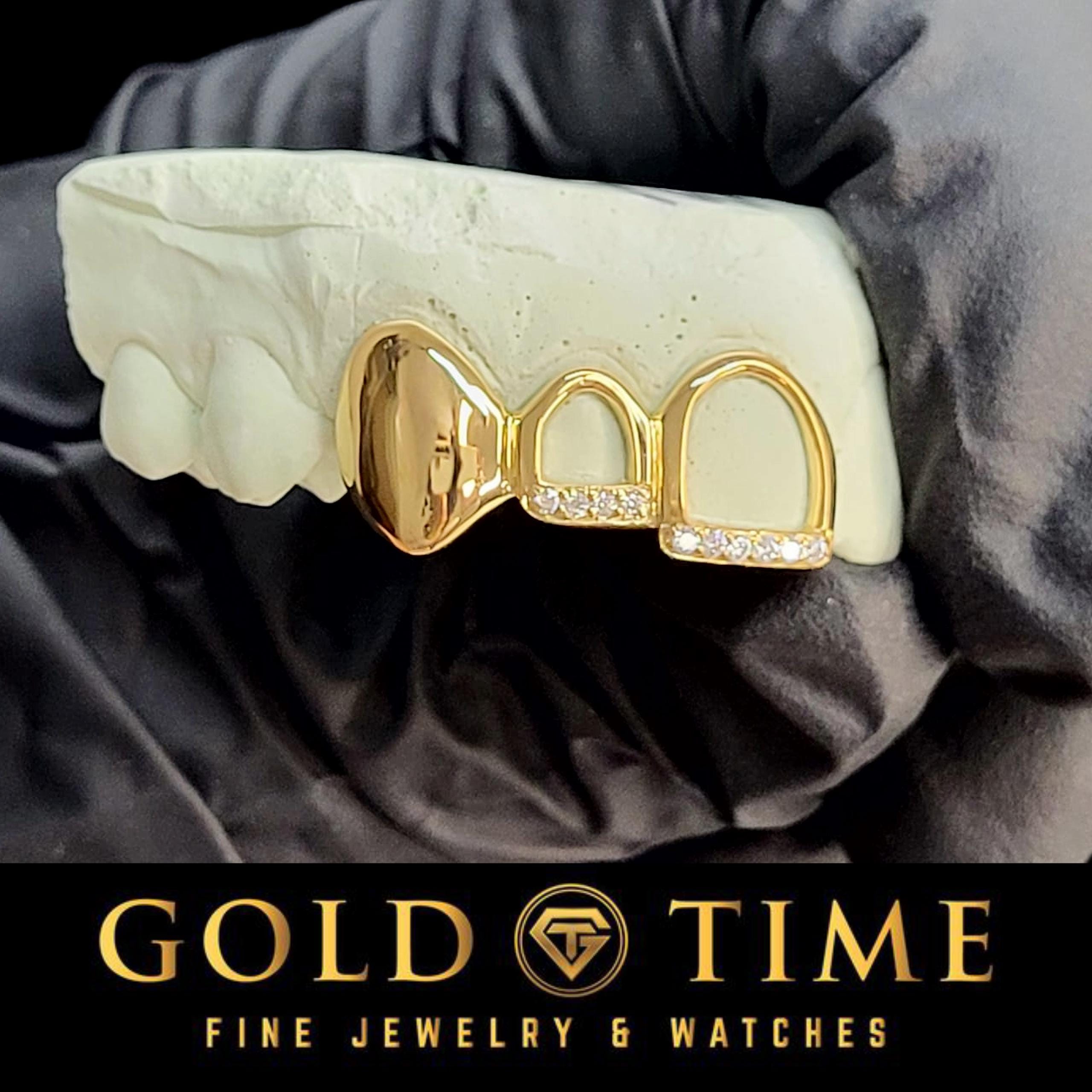 Custom Grillz - Triple Cap with Open Face Moissanite Tips, Solid Cap