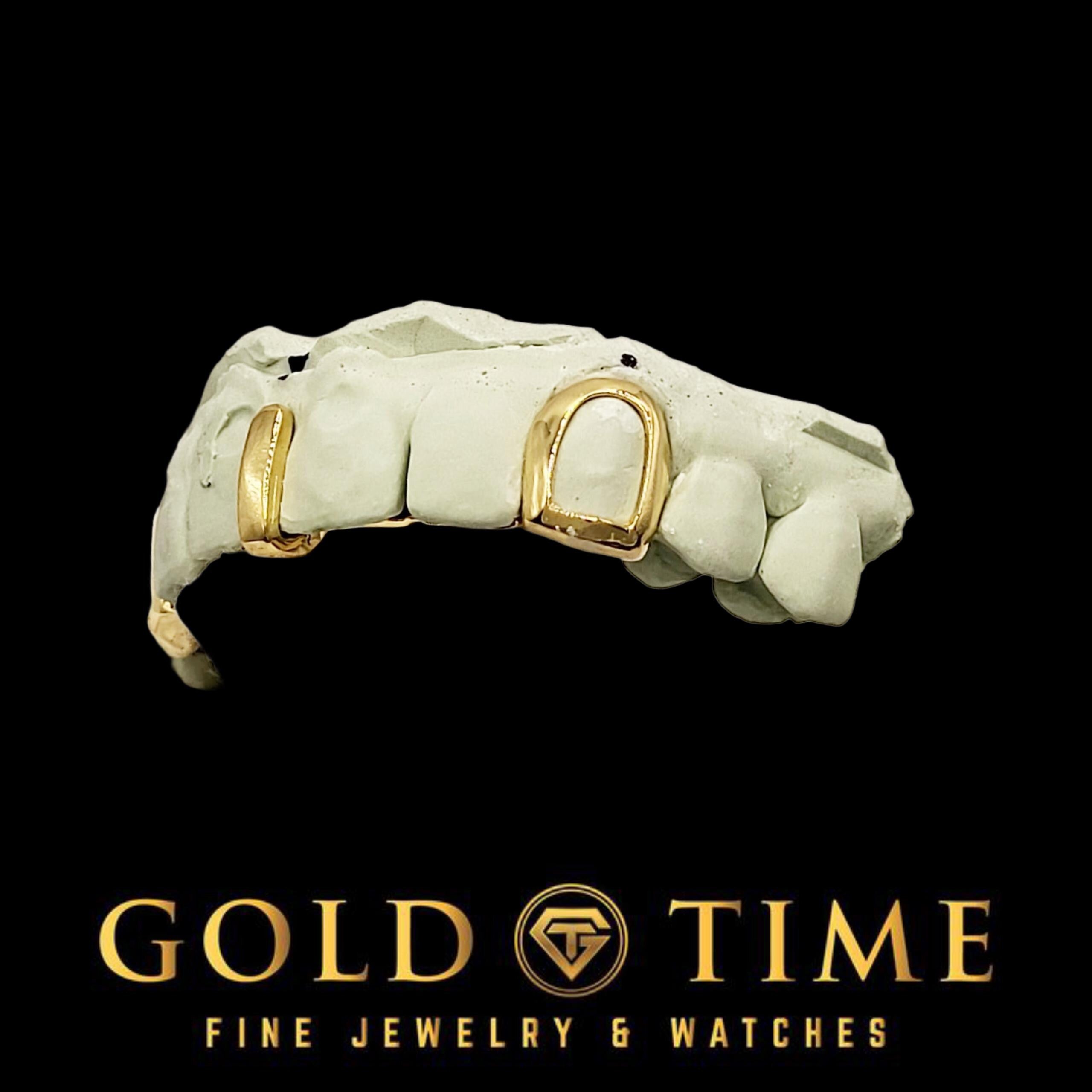 Custom 3-Piece Gold Grillz with Open Face Canines & Gap Bar