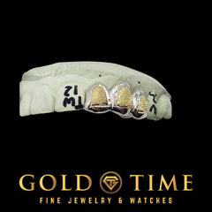 Custom Handmade Two Tone Box Dust Triple Cap Grillz