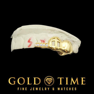 Custom 3 piece cross cut-out grillz with moissanite tip, angled view