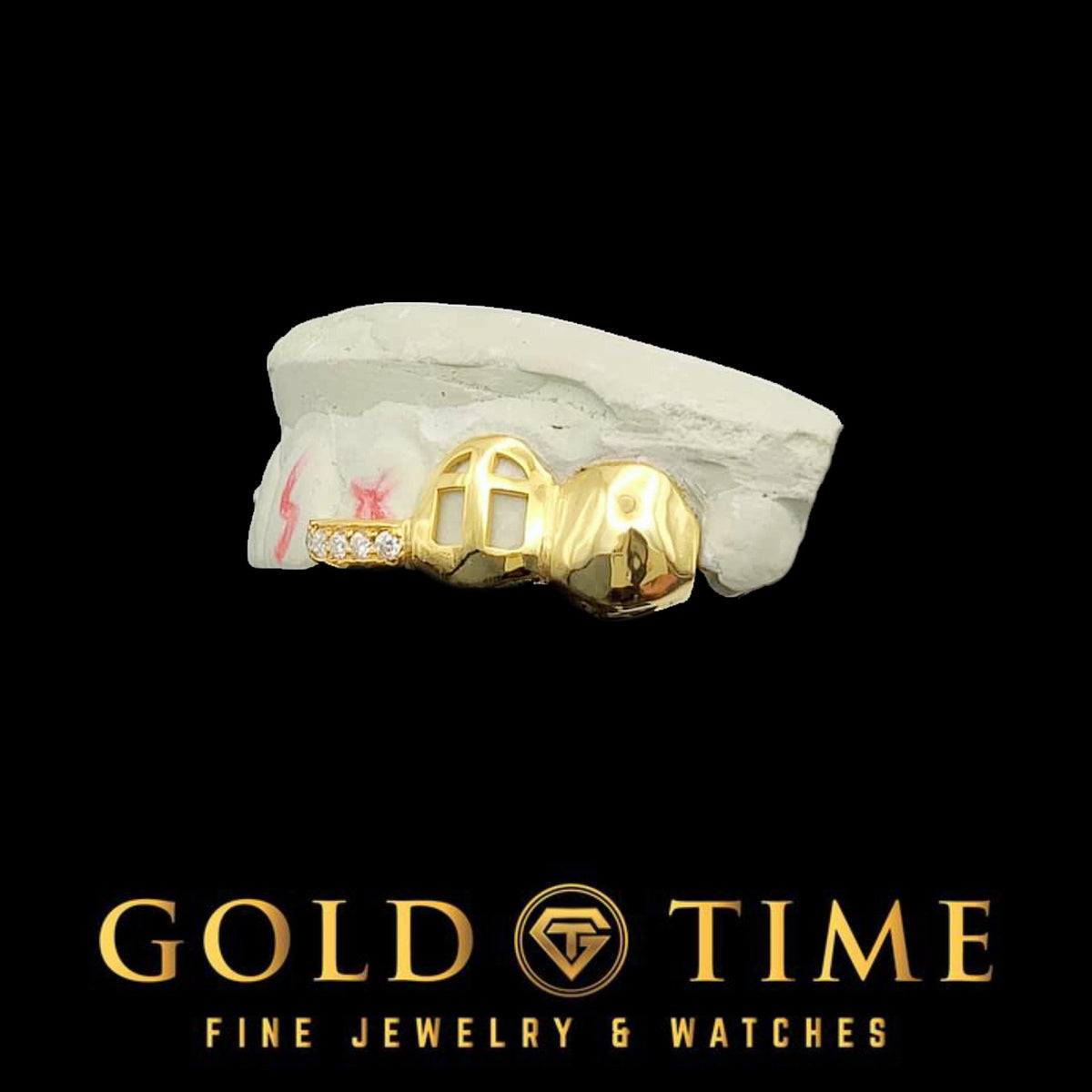 Custom 3-Piece Grillz Set: Solid, Cross Cut Out Open Face, Moissanite Tip