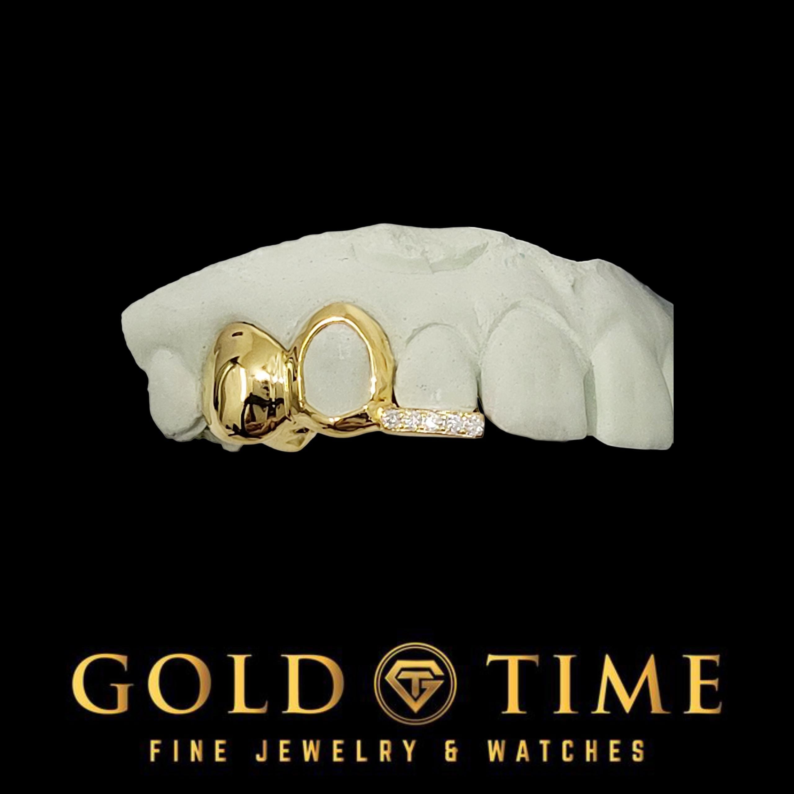 Custom 3-Piece Grillz Set: Solid, Open Face, Moissanite Tip - Includes Mold Kit