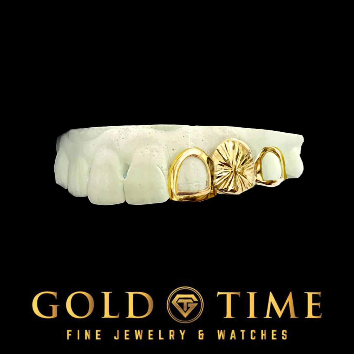 Custom Grillz - 3 Piece Starburst Diamond-Cut and Open Face Tooth Caps - Includes Impression Kit