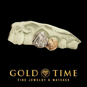 Two-tone double cap grillz in white and rose gold with crossing trillion diamond cuts and a diamond dust finish, on a dental mold