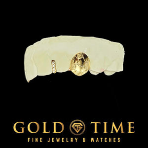 Yellow nugget textured single tooth cap beside a slim moissanite gap bar, on a dental mold