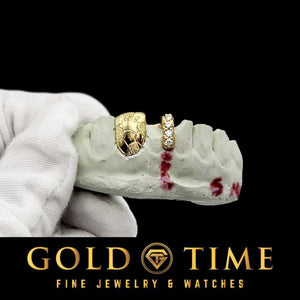Yellow nugget tooth cap and moissanite gap bar on a dental mold held in a gloved hand