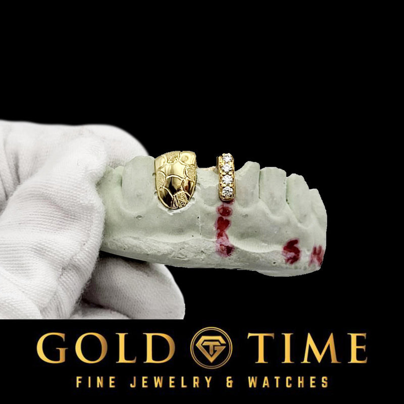 Yellow nugget tooth cap and moissanite gap bar on a dental mold held in a gloved hand