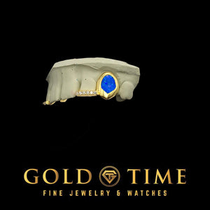 Yellow 2 piece grillz with a blue oval galaxy enamel center and a moissanite tip, on a dental mold