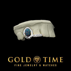 White 2 piece grillz with a dark blue and green galaxy enamel center and a moissanite tip, on a dental mold