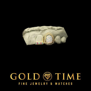 Angled view of the yellow gold opal and moissanite double cap grill with pink and blue tip stones