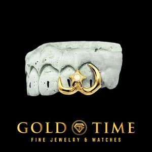 Yellow gold crescent moon and opal star double cap grill on a dental mold