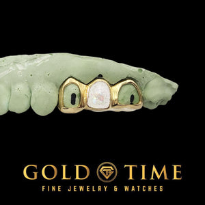 Close view of yellow 3 piece grillz with a pearly pink enamel center cap framed by two open face caps