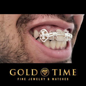 Man smiling with a white metal barbed wire grill with open face cross canines
