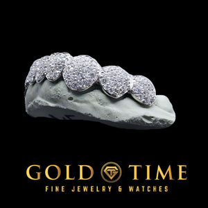 Angled view of white star cluster moissanite grillz showing clusters of mixed size stones on each cap