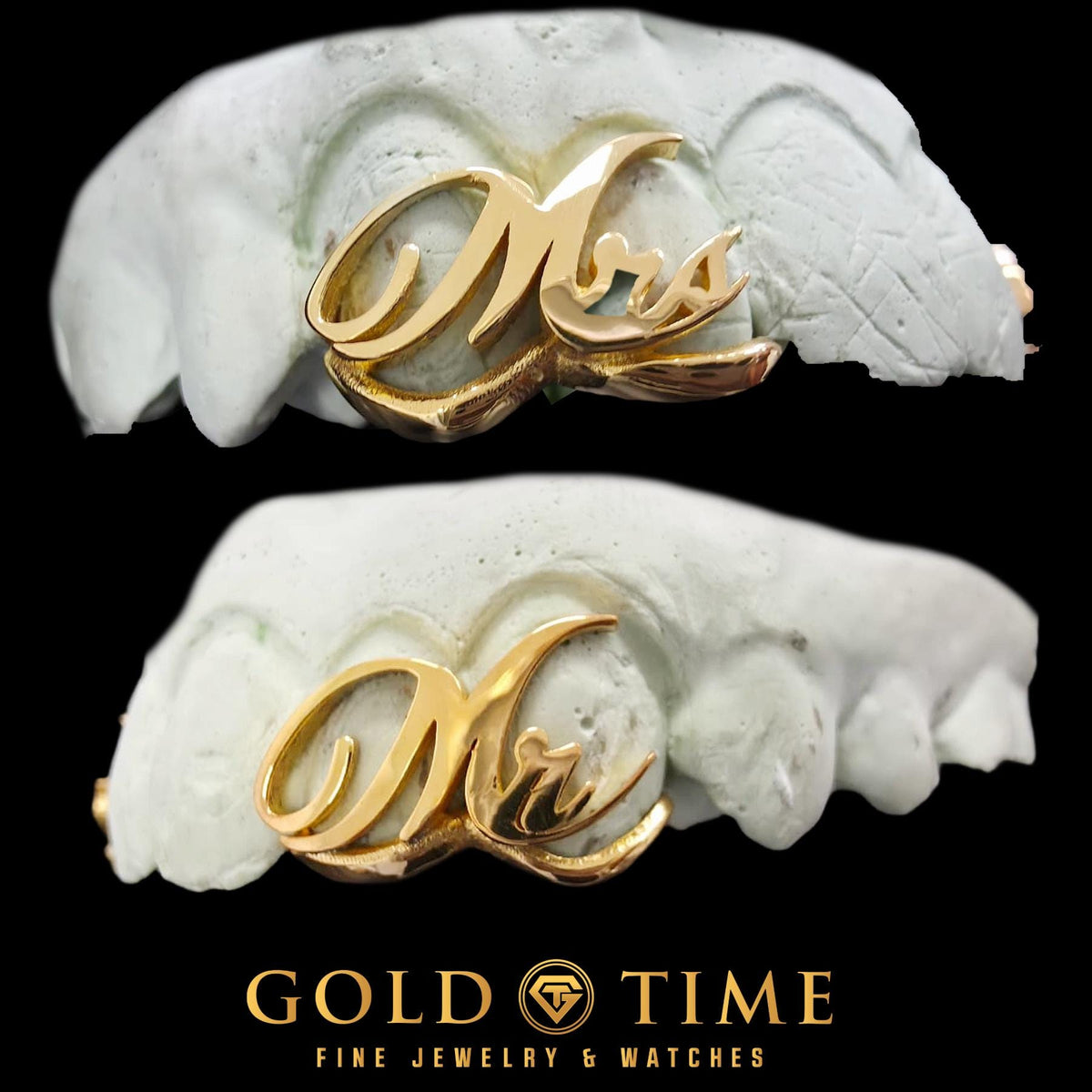 Custom Mr. & Mrs. Grillz Set - Wedding, Anniversary, Couple Jewelry