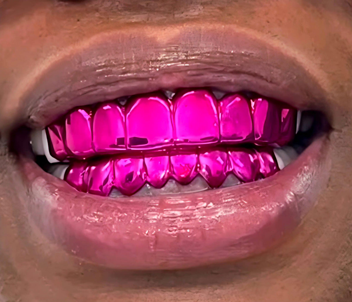 Smile wearing a top and bottom set of Neon Rose pink chrome grillz