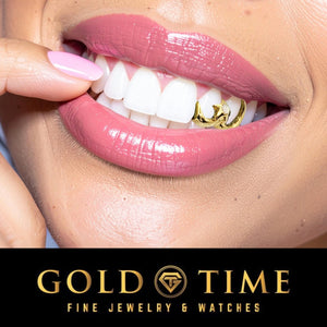 Smiling woman wearing the yellow gold moon and opal star grill